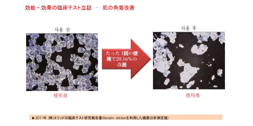 肌の角質改善
