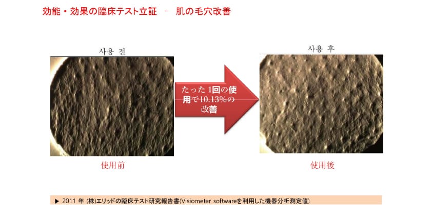 肌の毛穴改善