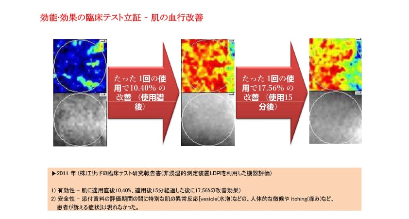 血行改善